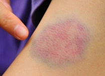 Biberiye Yağı Morluk Biberiye Yağı Morluk